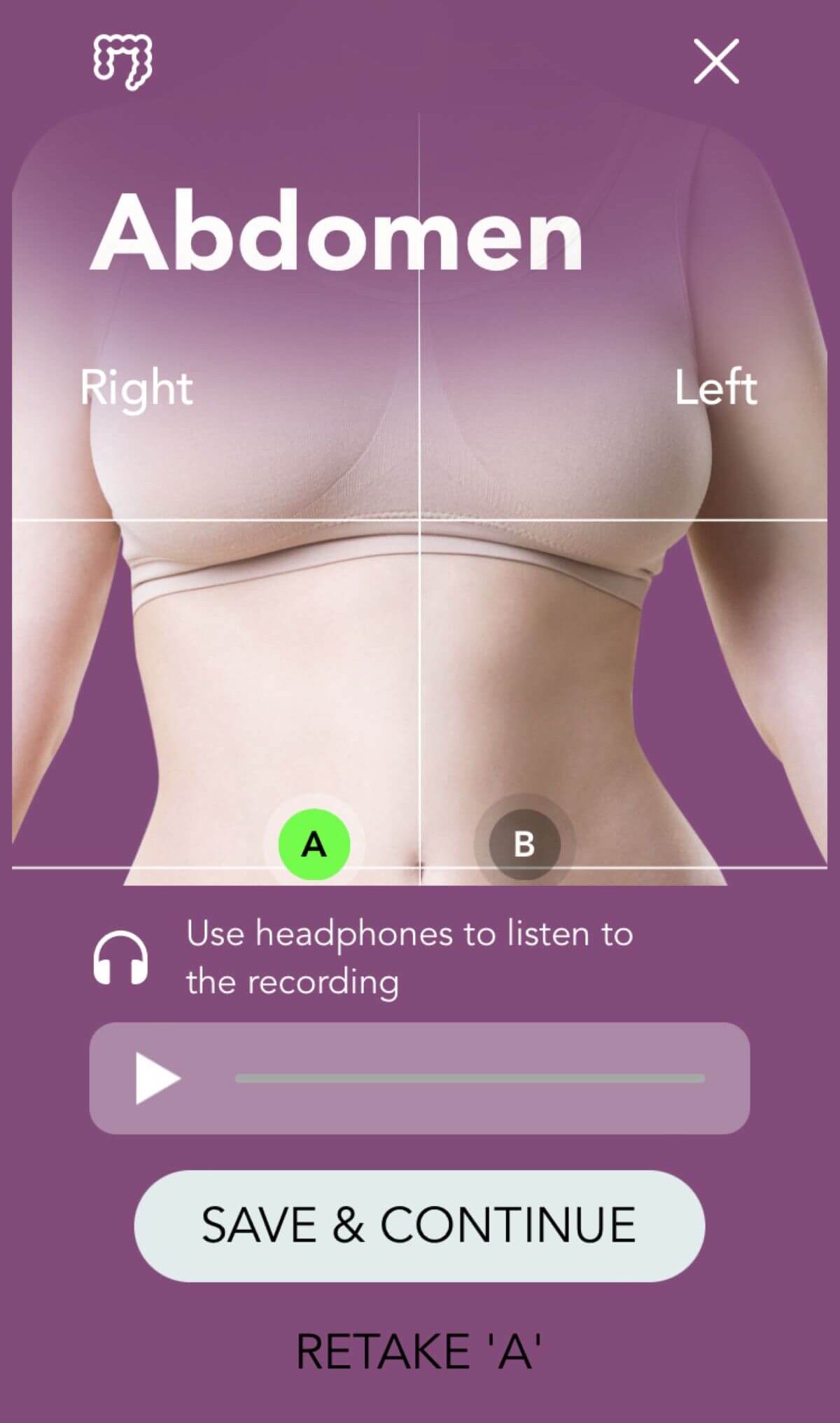 Abdomen - NONAGON Knowledge Base